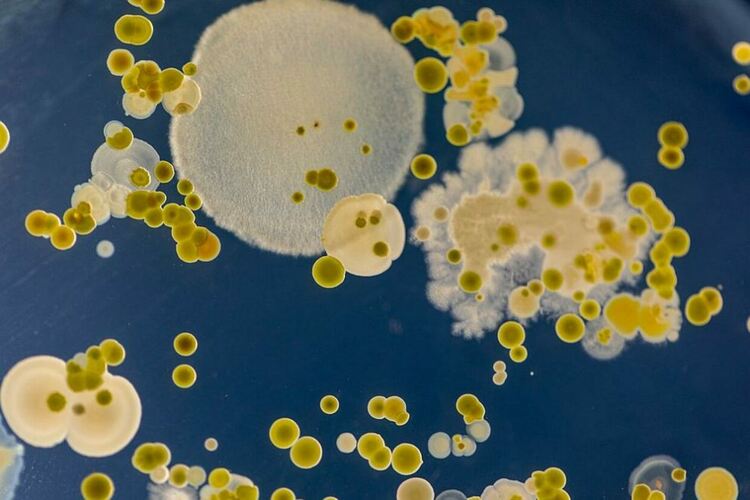 Парадокси в лечението с антибиотици и как губим битката срещу бактериите